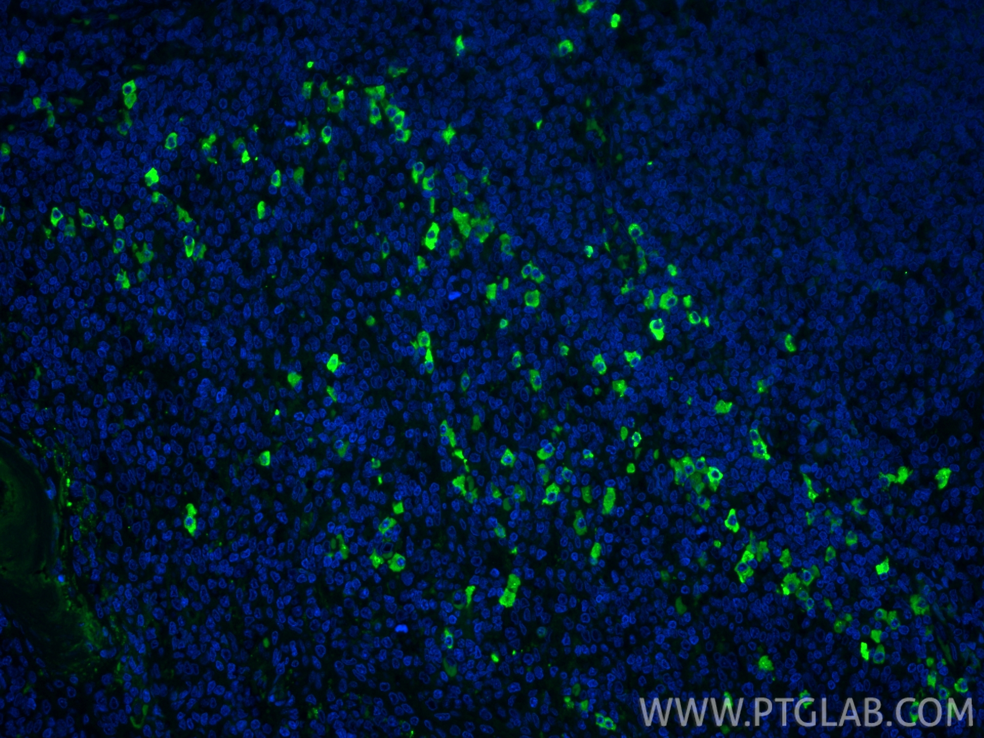 Immunofluorescent analysis of (4% PFA) fixed paraffin-embedded human tonsillitis tissue using CoraLite® Plus 488 IgG Kappa Light Chain antibody (CL488-11781) at dilution of 1:200. Heat mediated antigen retrieval with Tris-EDTA buffer (pH 9.0). IF Staining of human tonsillitis using CL488-11781