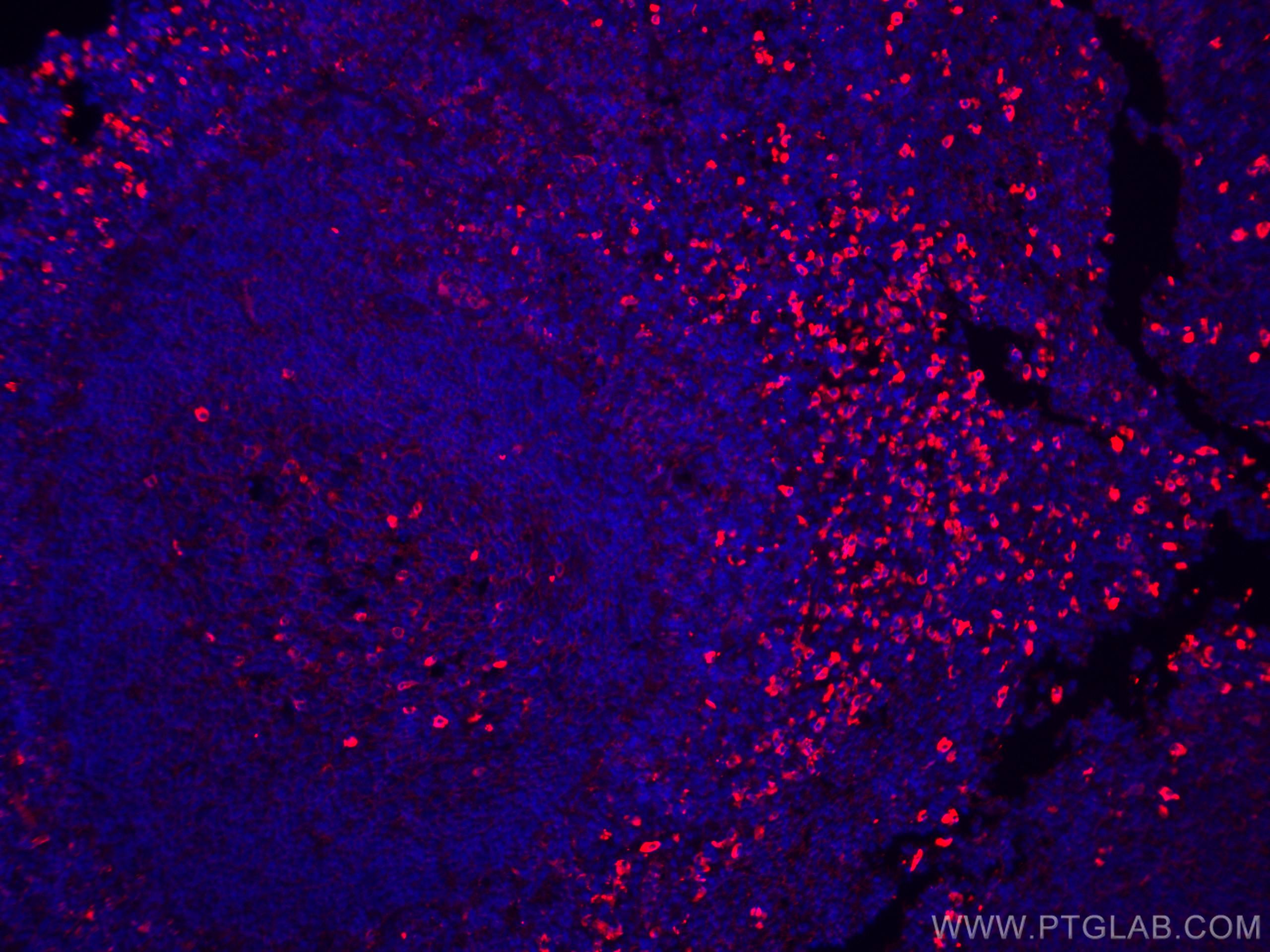 IF Staining of human tonsillitis using CL594-20758