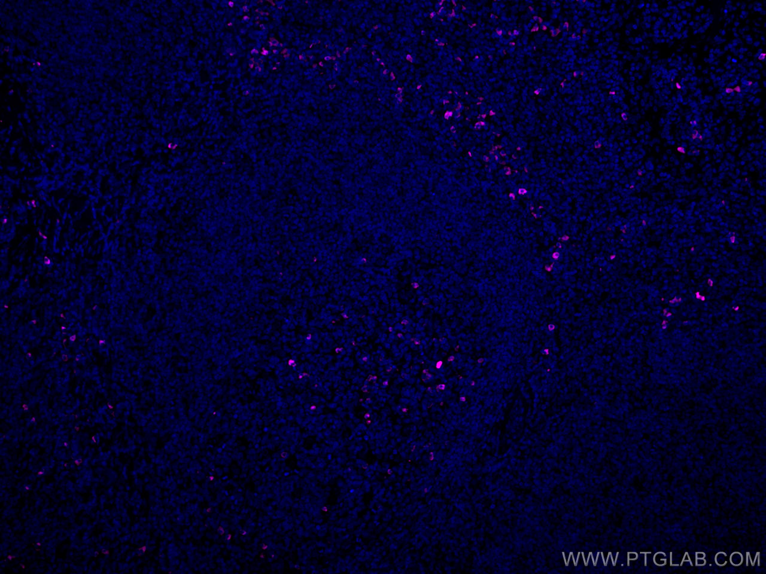 IgG Lambda Light Chain