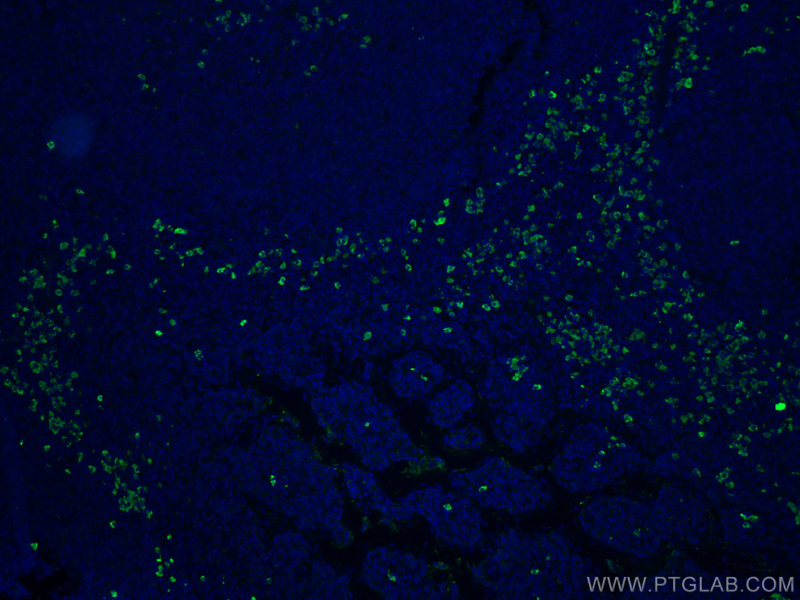 IF Staining of human tonsillitis using 20758-1-AP