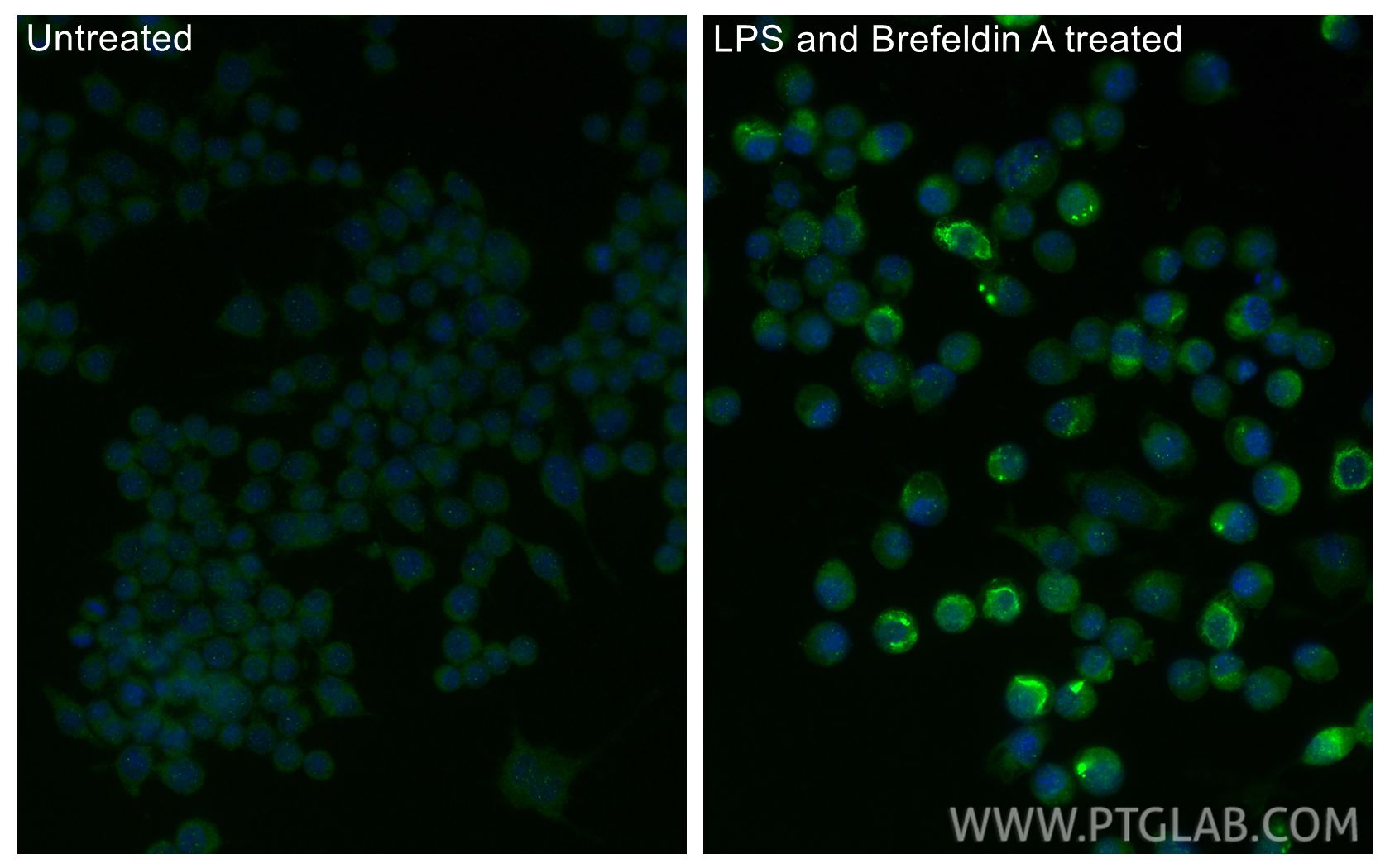 IF Staining of RAW 264.7 using 29530-1-AP