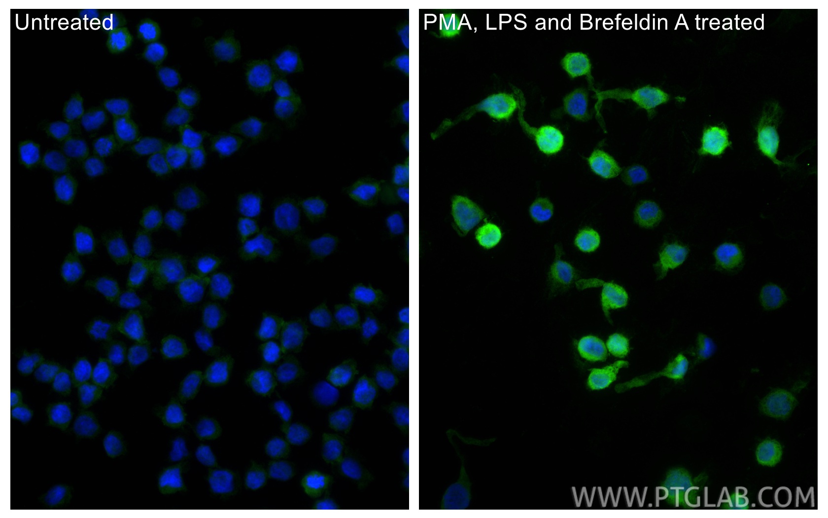 Immunofluorescent analysis of (4% PFA) fixed PMA, LPS and Brefeldin A treated THP-1 cells using IL-1 beta antibody (26048-1-AP) at dilution of 1:200 and CoraLite®488-Conjugated Goat Anti-Rabbit IgG(H+L) (<a class='green' href='/productredirect?CatalogNo=SA00013-2' target='_blank'>SA00013-2</a>). IF Staining of THP-1 using 26048-1-AP