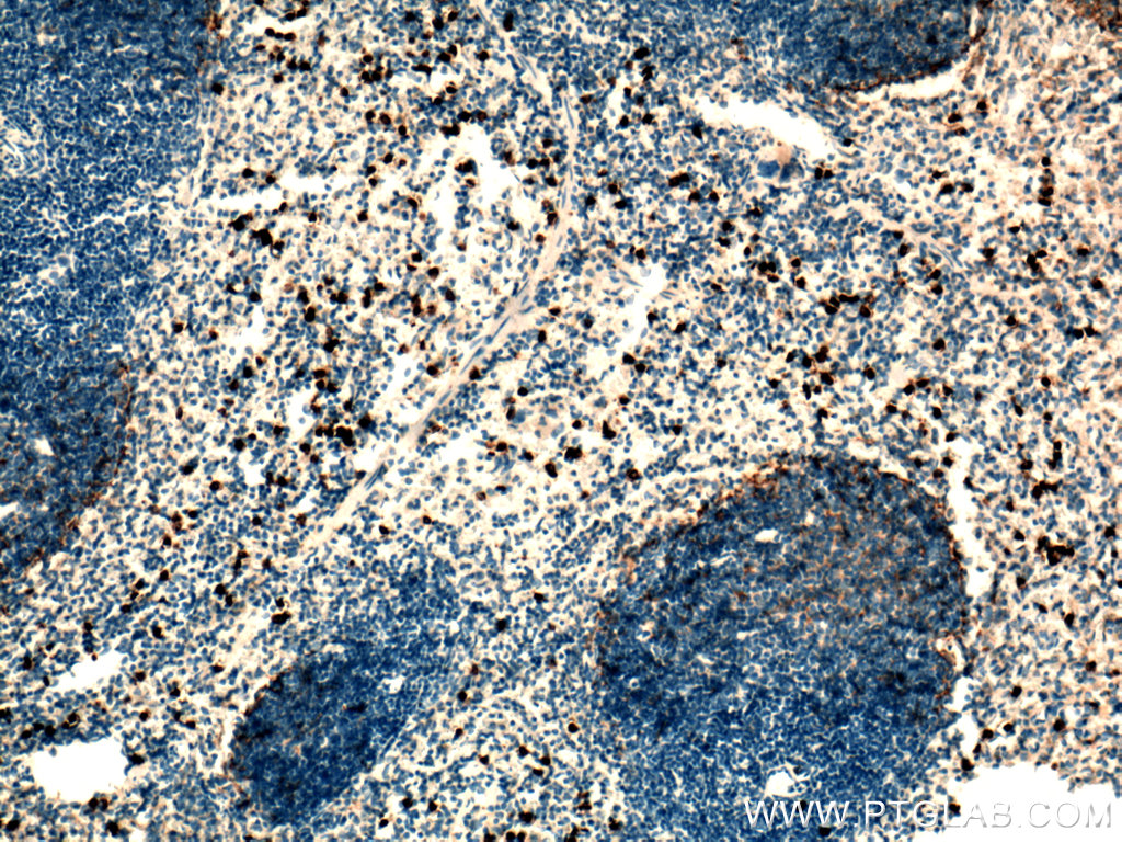 IHC staining of mouse spleen using 19538-1-AP
