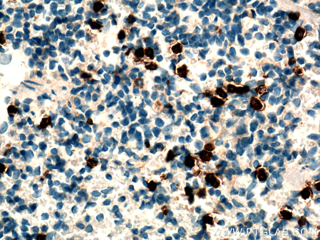 IHC staining of mouse spleen using 19538-1-AP