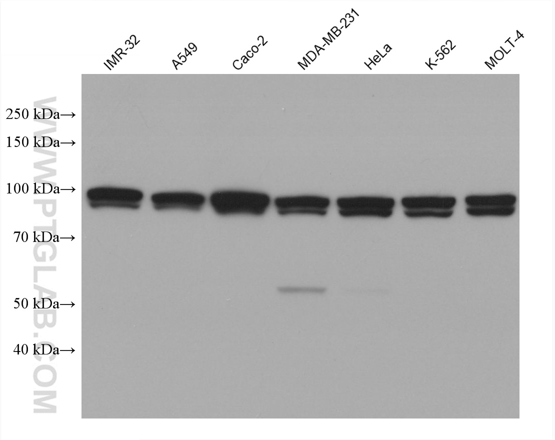 WB analysis using 67597-1-Ig (same clone as 67597-1-PBS)