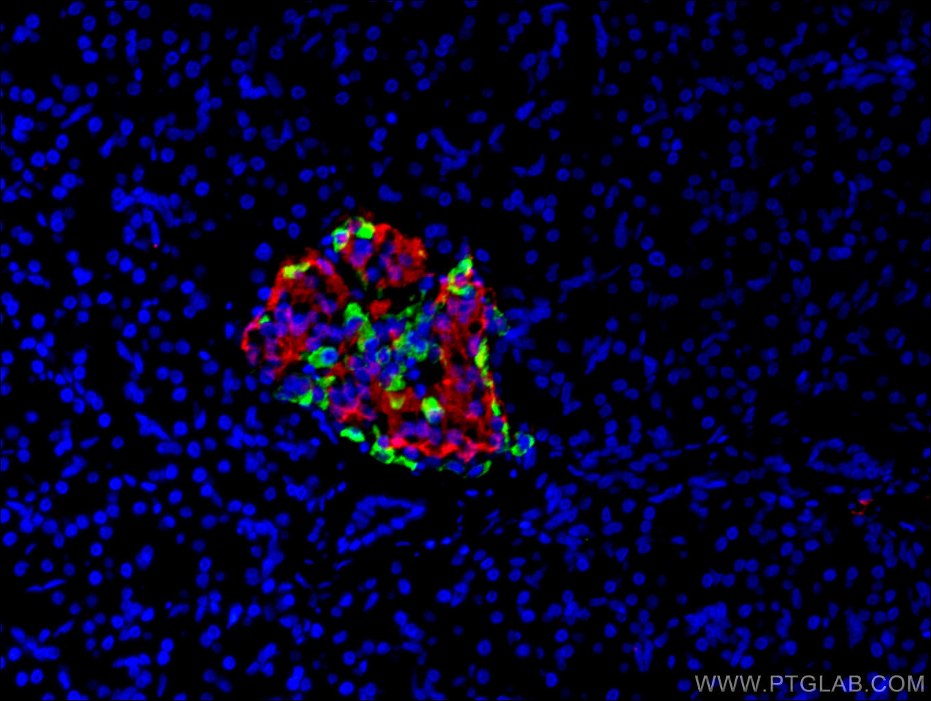 IF Staining of human pancreas using 66198-1-Ig