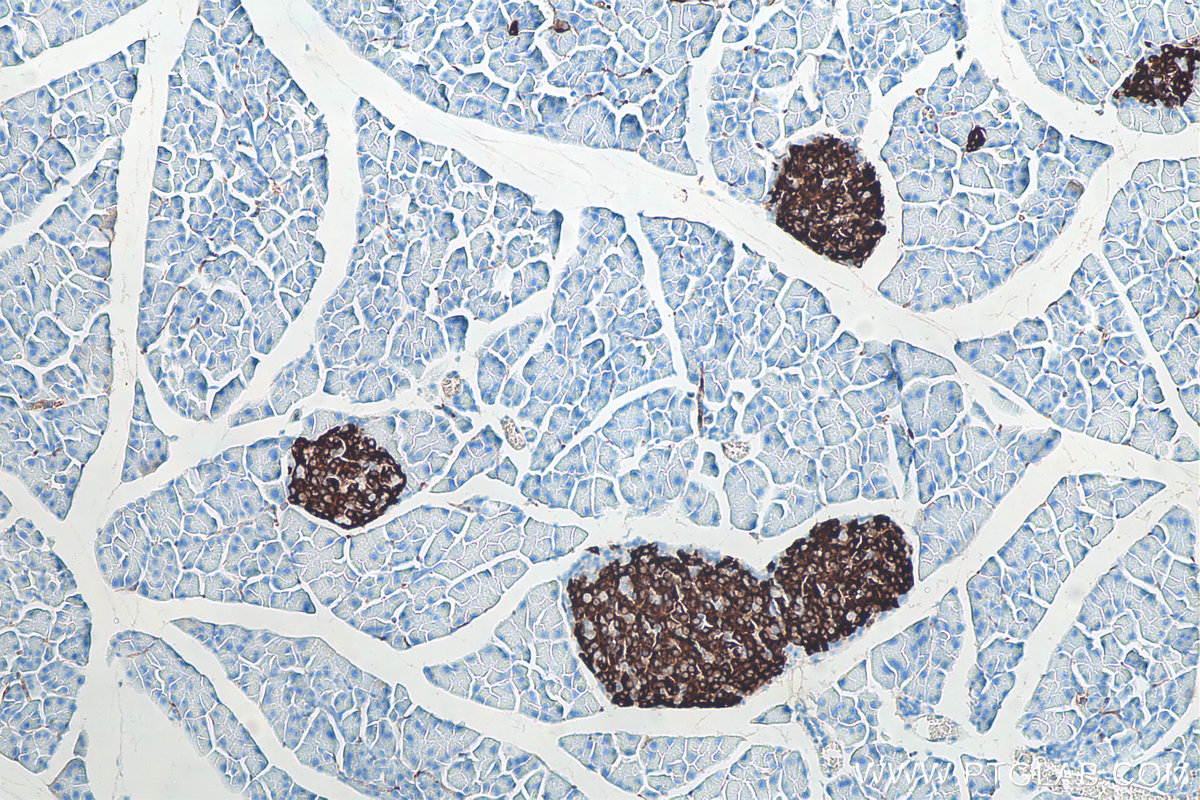 IHC staining of mouse pancreas using 66198-1-Ig IHC staining of mouse pancreas using 66198-1-Ig