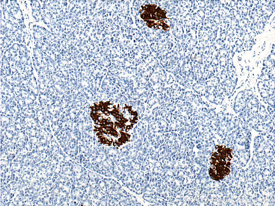 IHC staining of human pancreas using 66198-1-Ig