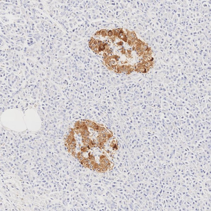 IHC staining of human pancreas using 66198-1-Ig IHC staining of human pancreas using 66198-1-Ig