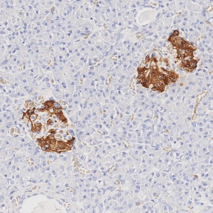 IHC staining of human pancreas using 66198-1-Ig IHC staining of human pancreas using 66198-1-Ig