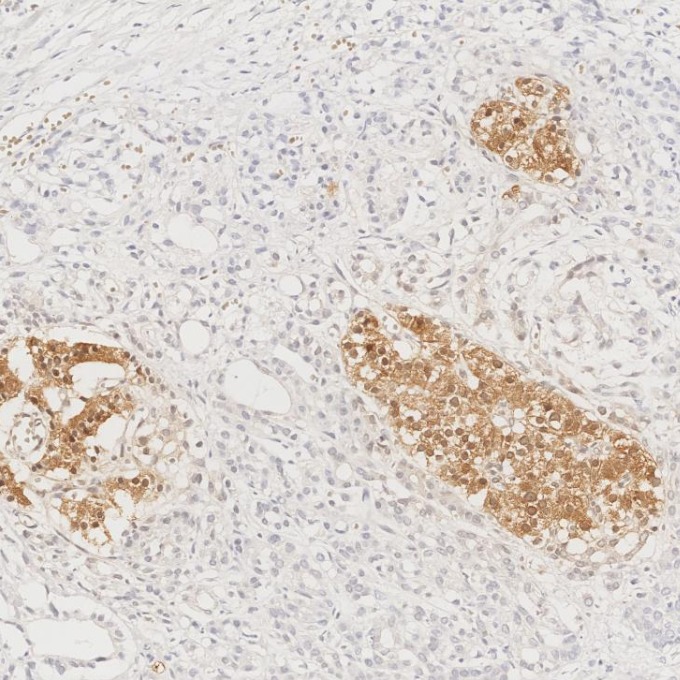 IHC staining of human pancreas using 66198-1-Ig IHC staining of human pancreas using 66198-1-Ig