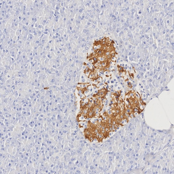 IHC staining of human pancreas using 66198-1-Ig IHC staining of human pancreas using 66198-1-Ig