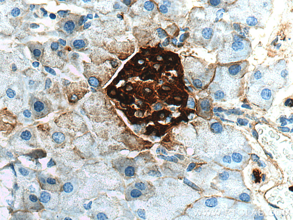 IHC staining of mouse pancreas using 28588-1-AP