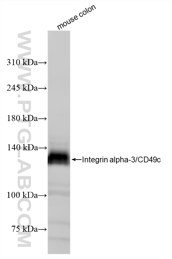 WB analysis of mouse colon using 88002-1-RR WB analysis of mouse colon using 88002-1-RR