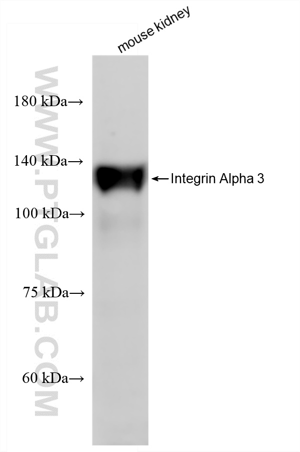 WB analysis of mouse kidney using 88002-1-RR WB analysis of mouse kidney using 88002-1-RR