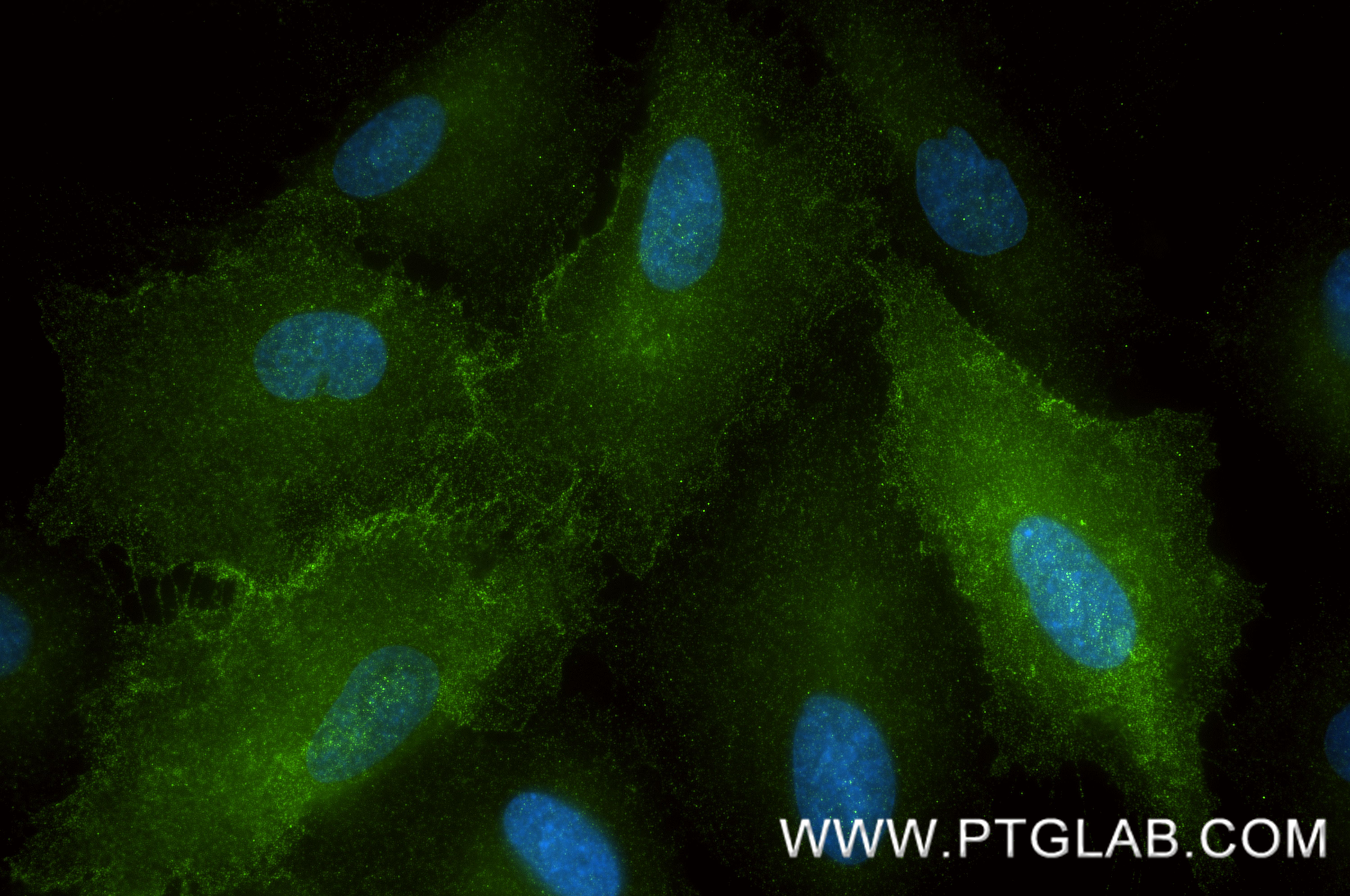 IF Staining of A549 using 88169-1-RR IF Staining of A549 using 88169-1-RR