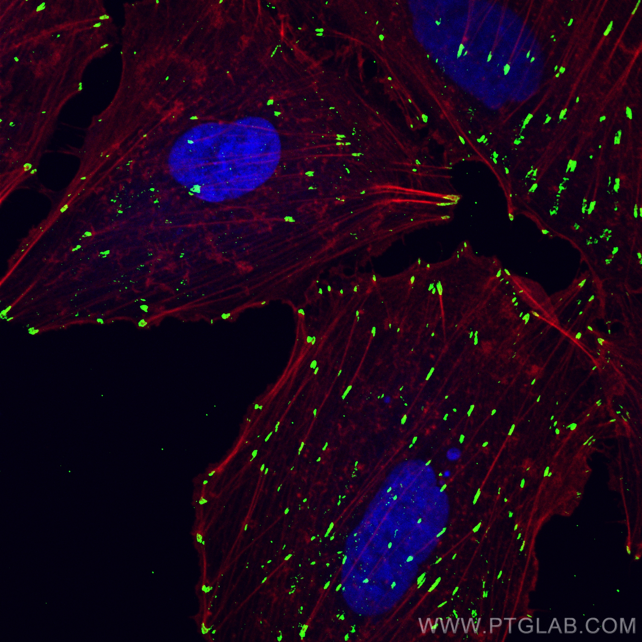 IF Staining of A549 using CL488-27096