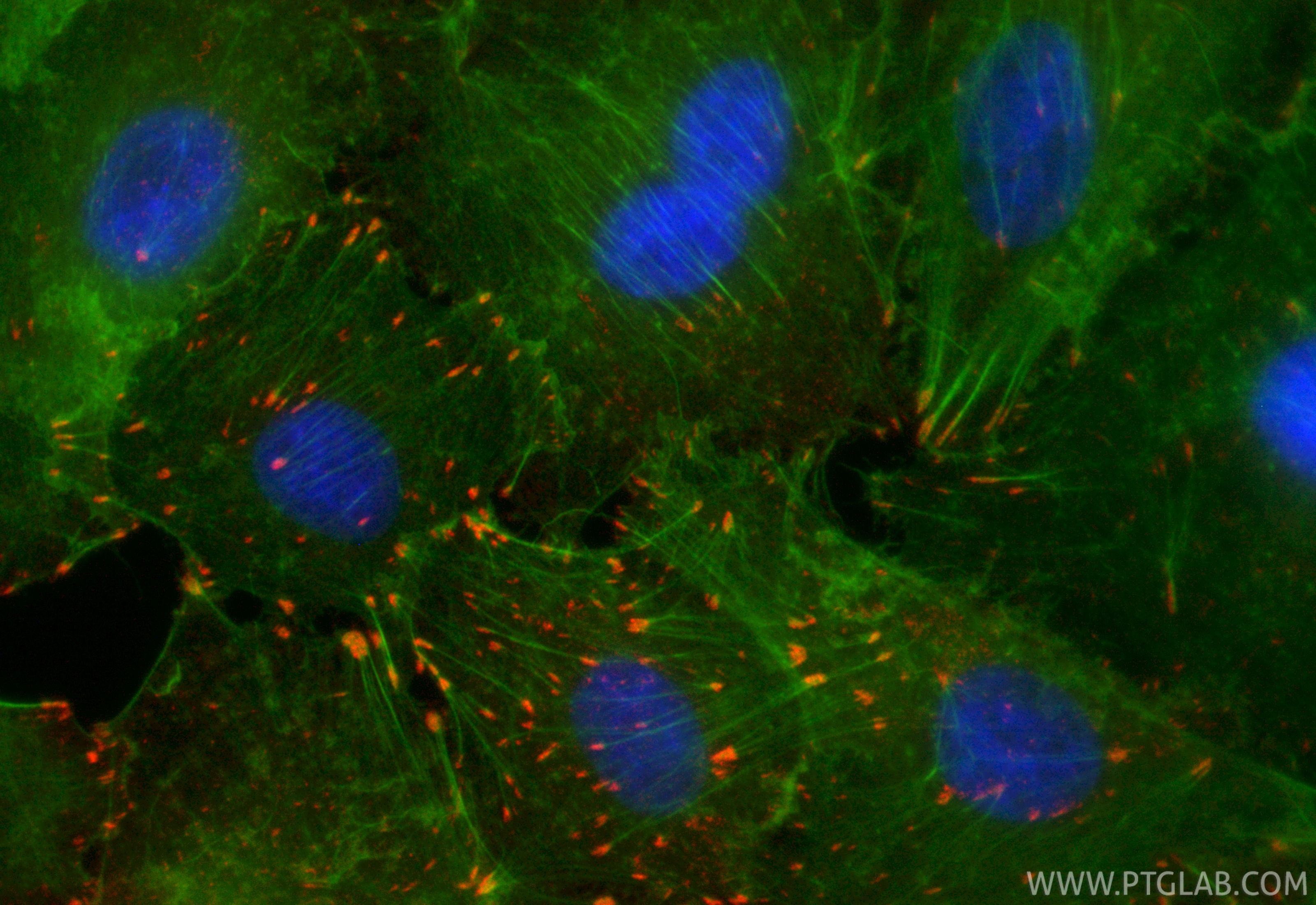 IF Staining of A549 using CL594-84883-5