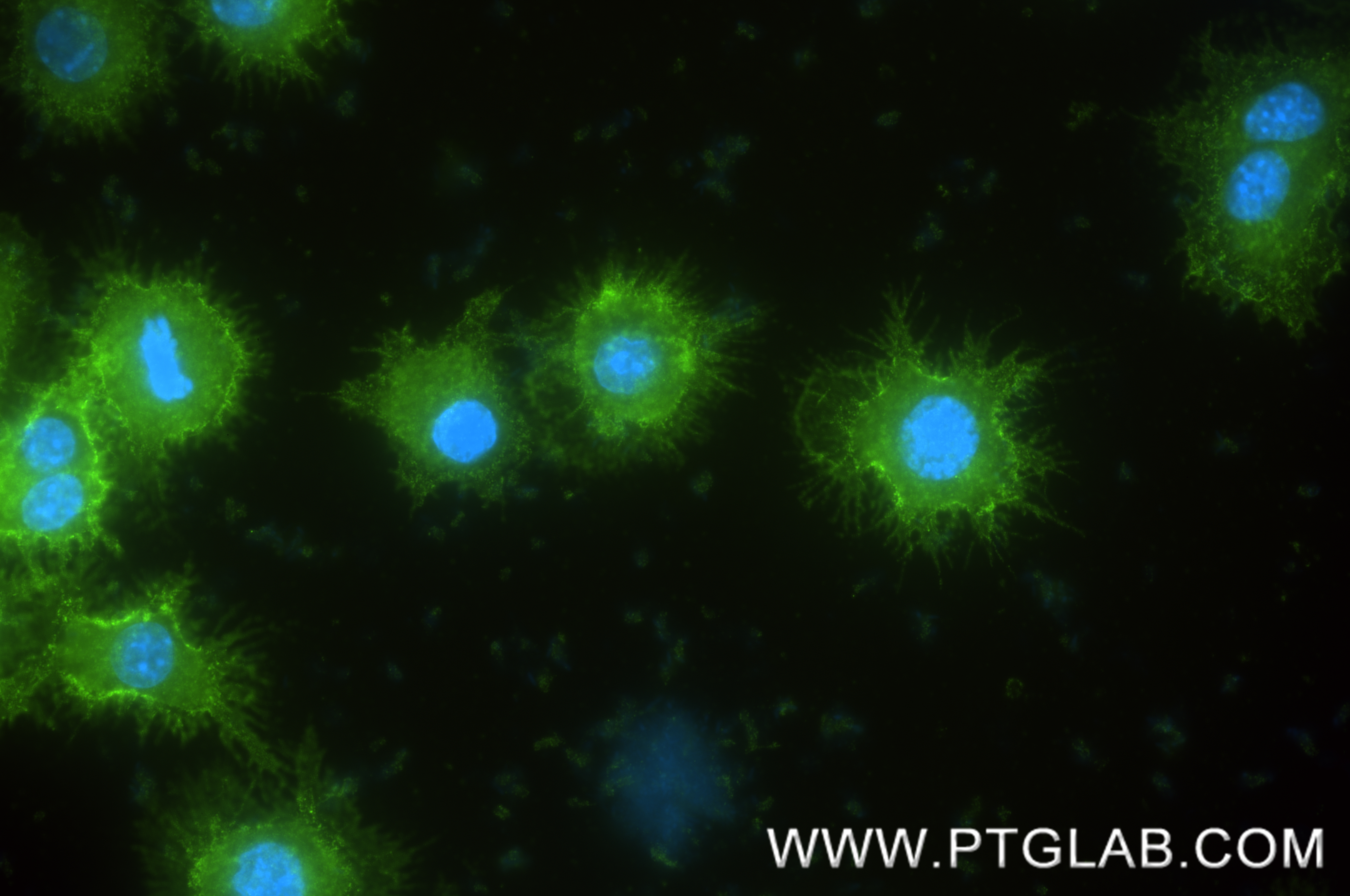 IF Staining of RAW 264.7 using 87495-1-RR (same clone as 87495-1-PBS)