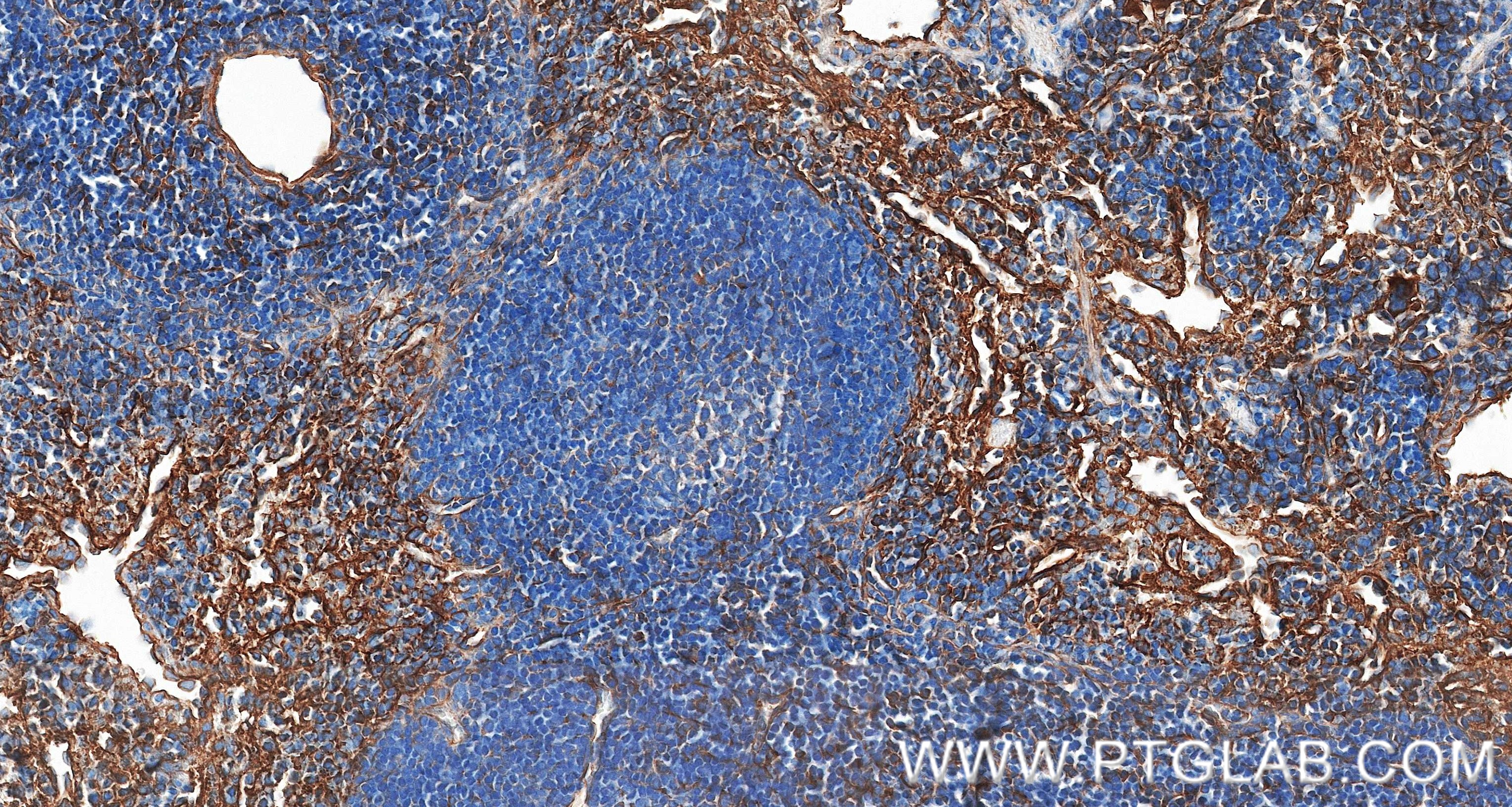 IHC staining of mouse spleen using 87495-1-RR (same clone as 87495-1-PBS)