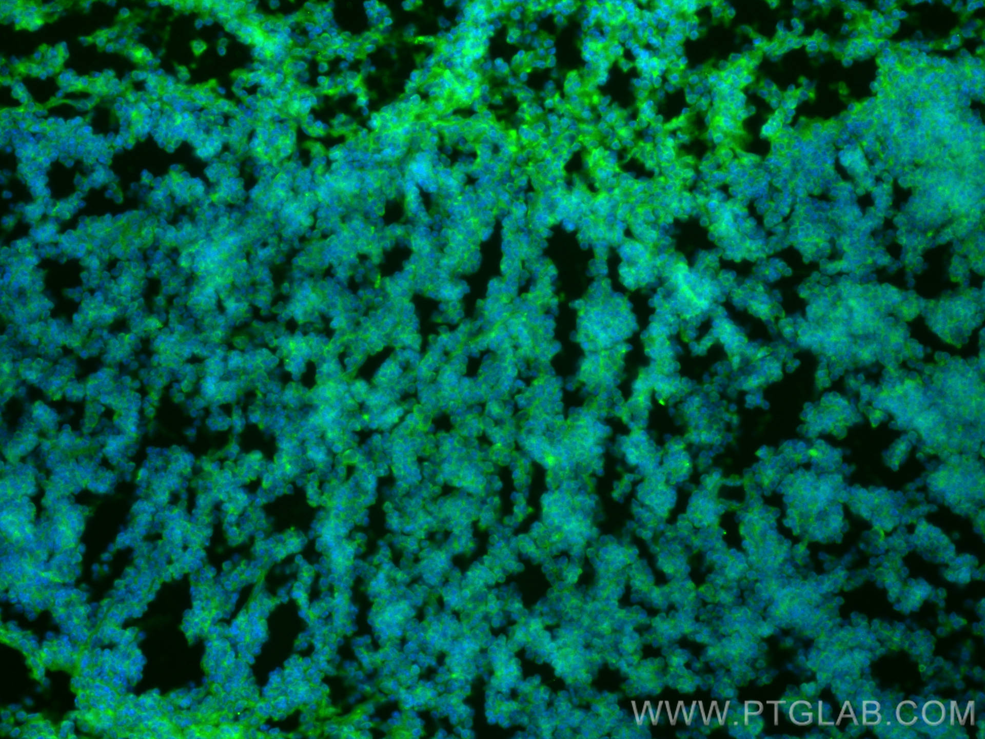 IF Staining of mouse spleen using 29042-1-AP