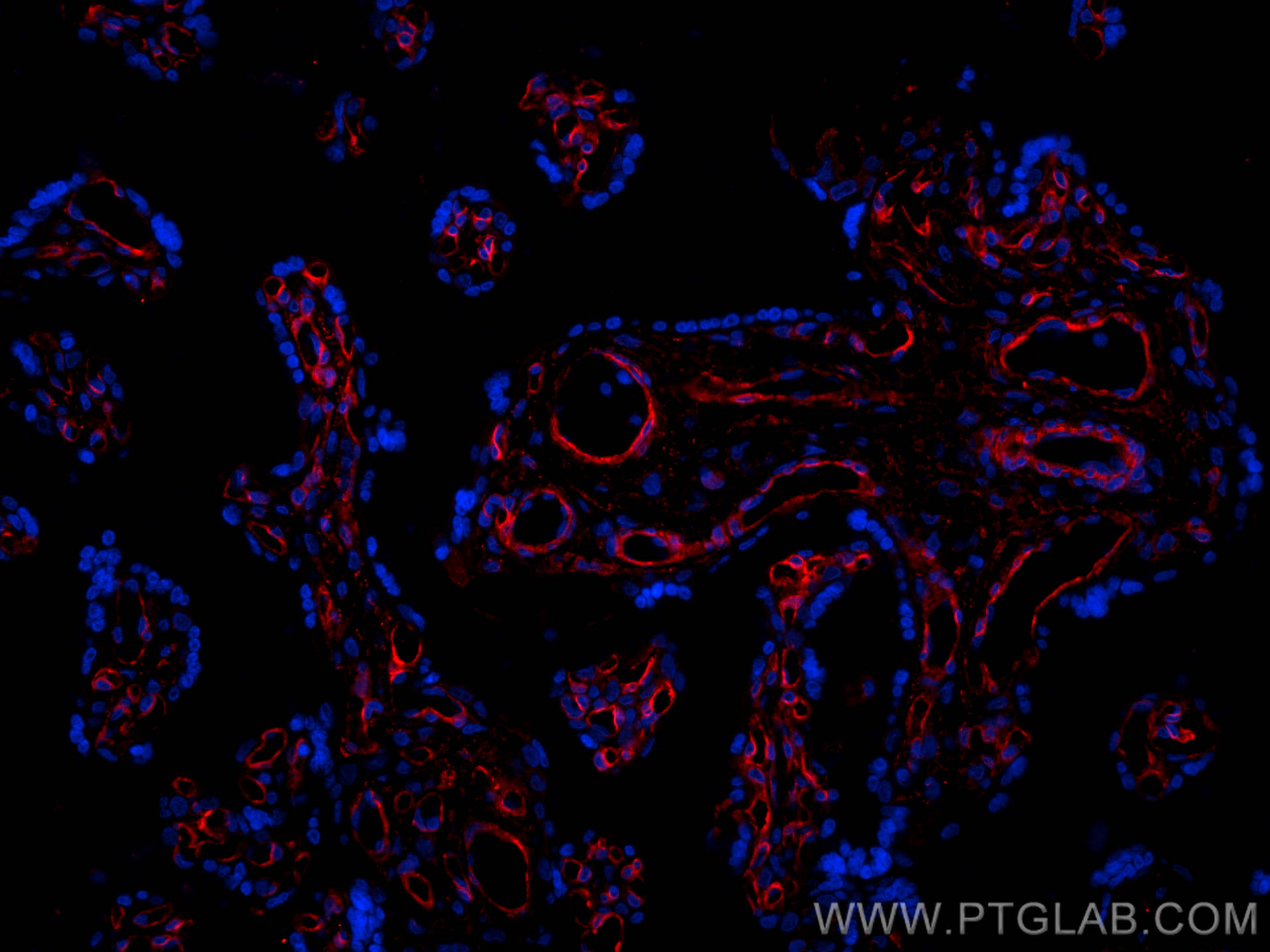 IF Staining of human placenta using 29042-1-AP