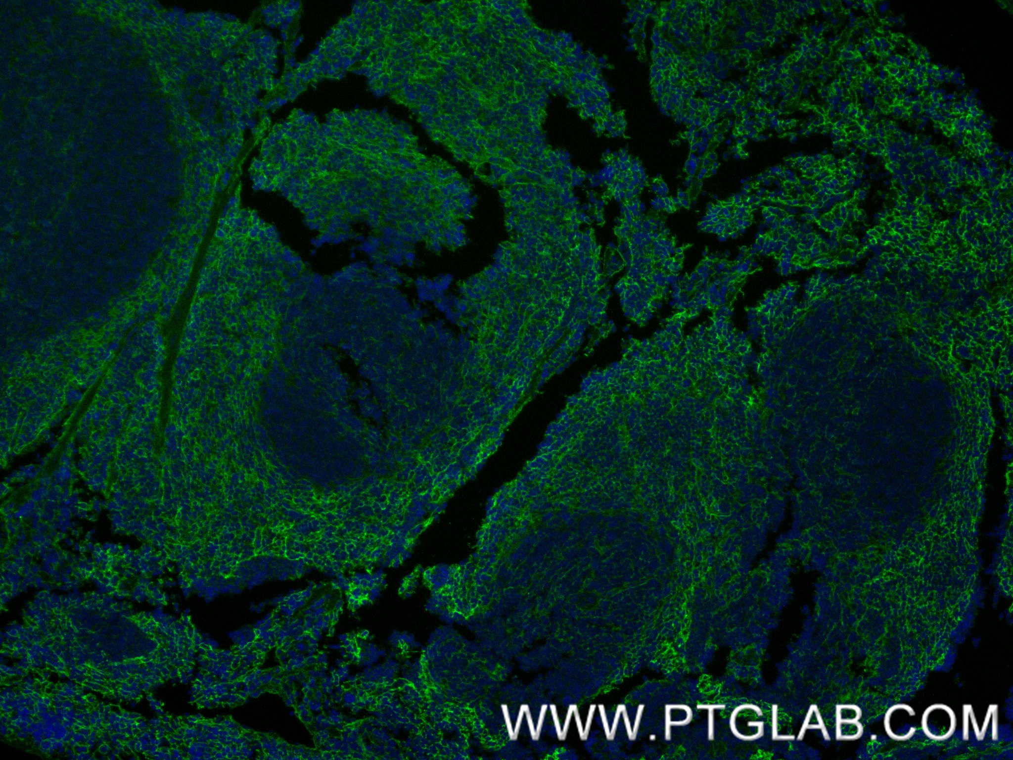 IF Staining of mouse spleen using 87056-3-RR (same clone as 87056-3-PBS) IF Staining of mouse spleen using 87056-3-RR (same clone as 87056-3-PBS)