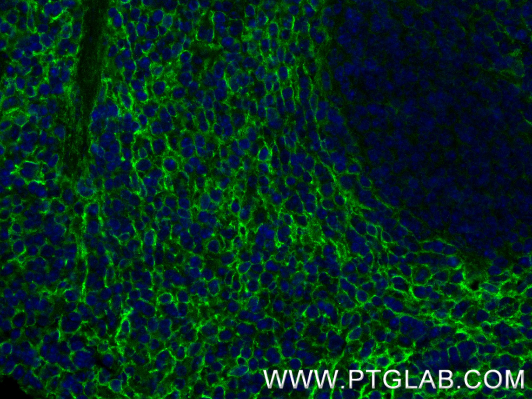 IF Staining of mouse spleen using 87056-3-RR (same clone as 87056-3-PBS) IF Staining of mouse spleen using 87056-3-RR (same clone as 87056-3-PBS)