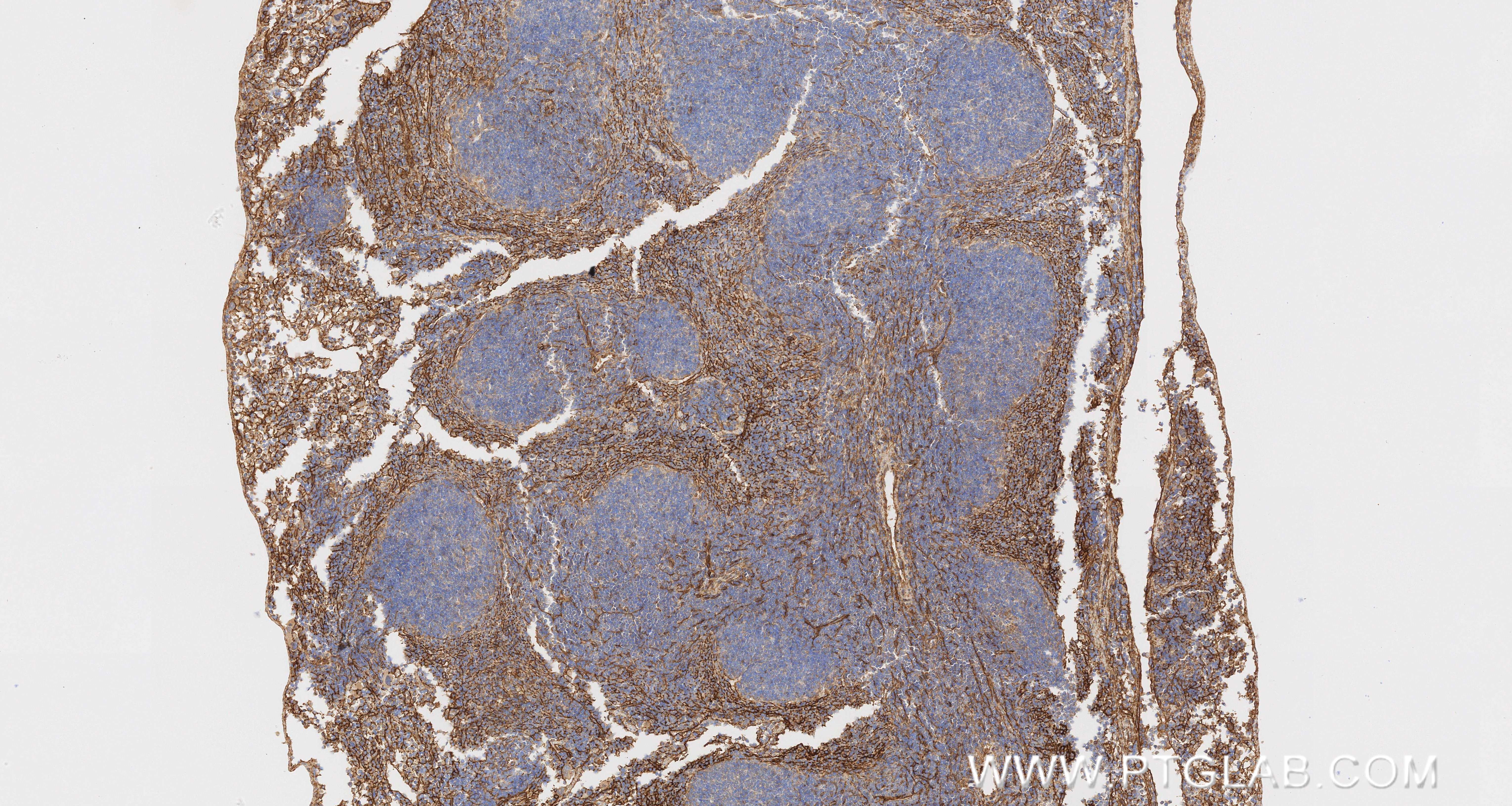 IHC staining of mouse spleen using 87056-3-RR (same clone as 87056-3-PBS) IHC staining of mouse spleen using 87056-3-RR (same clone as 87056-3-PBS)