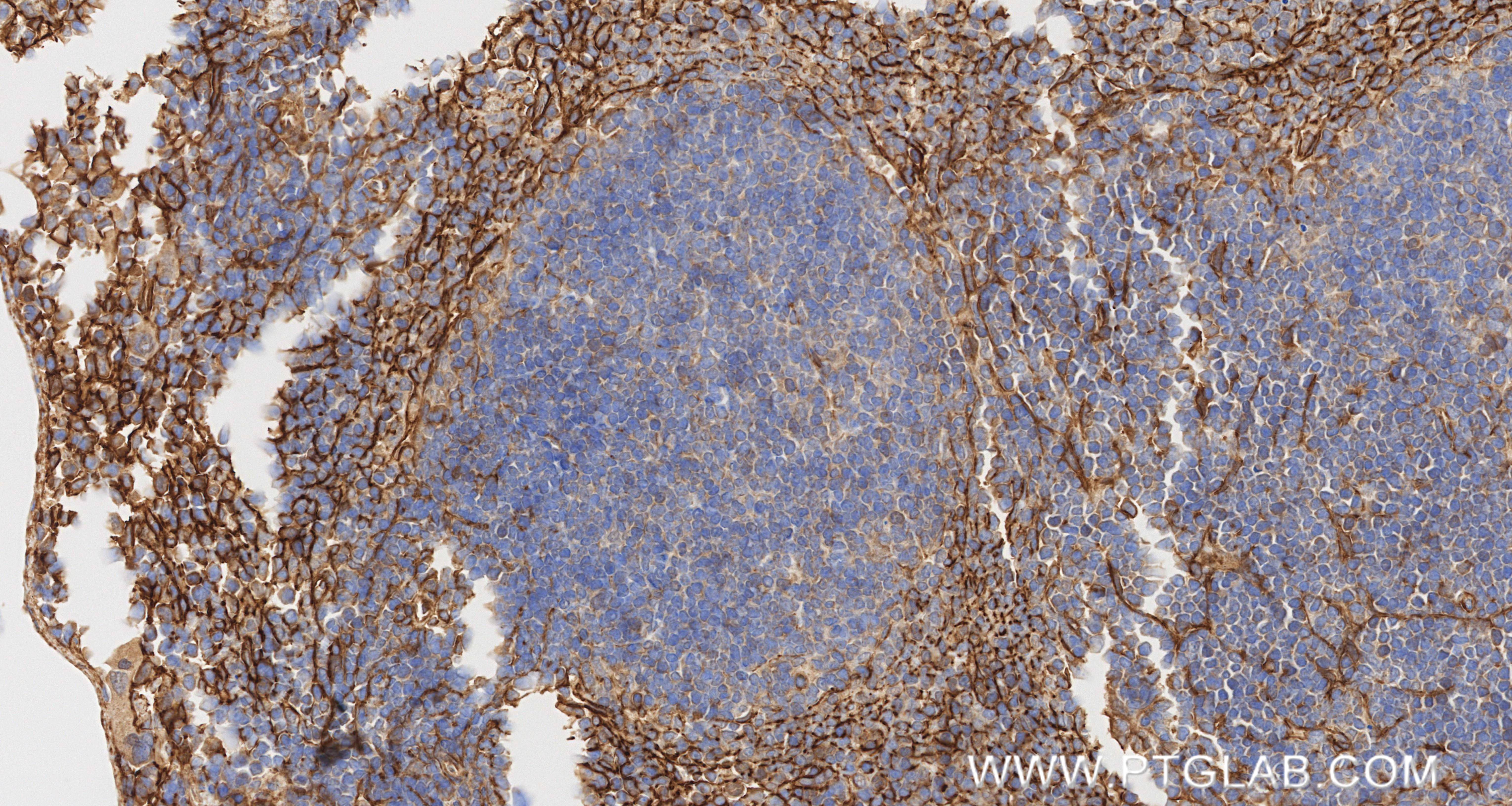 IHC staining of mouse spleen using 87056-3-RR (same clone as 87056-3-PBS) IHC staining of mouse spleen using 87056-3-RR (same clone as 87056-3-PBS)