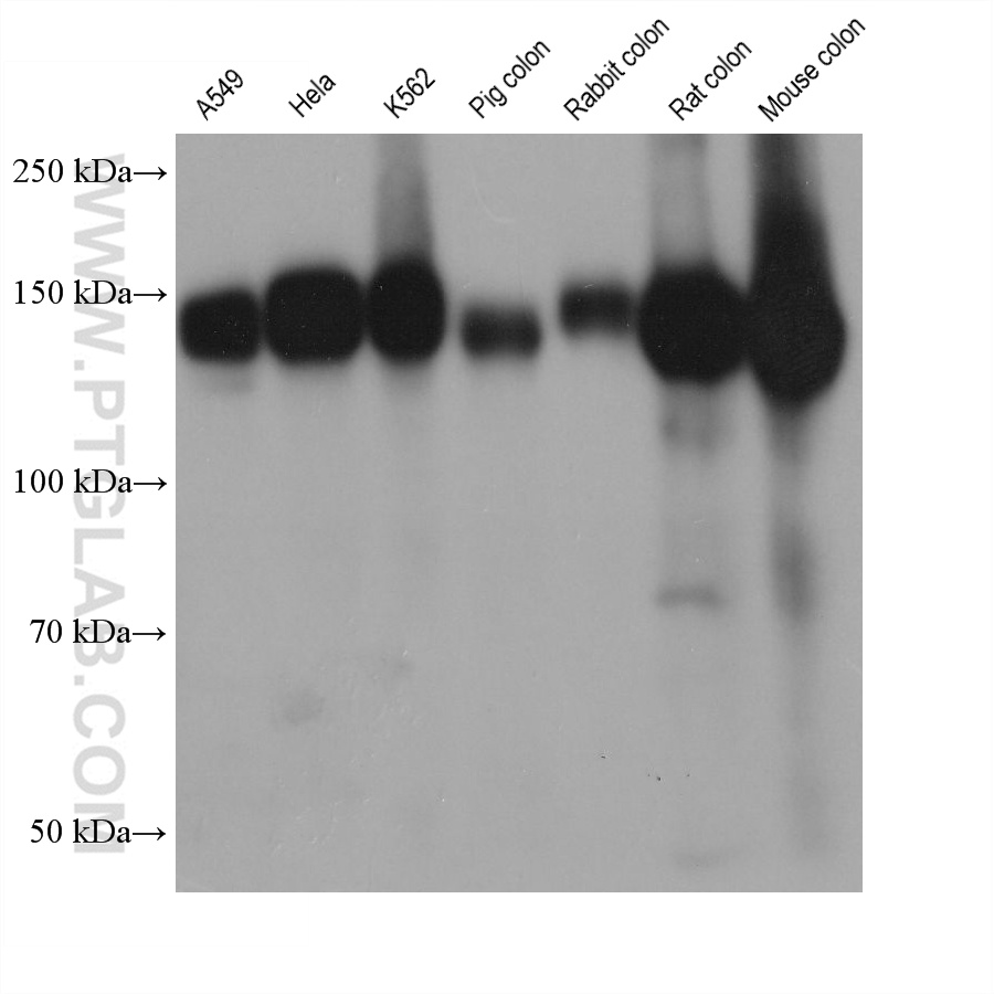 WB analysis using 68561-1-Ig