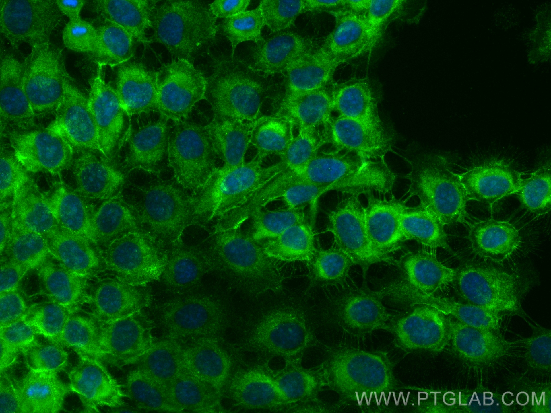 IF Staining of A431 using 27189-1-AP IF Staining of A431 using 27189-1-AP