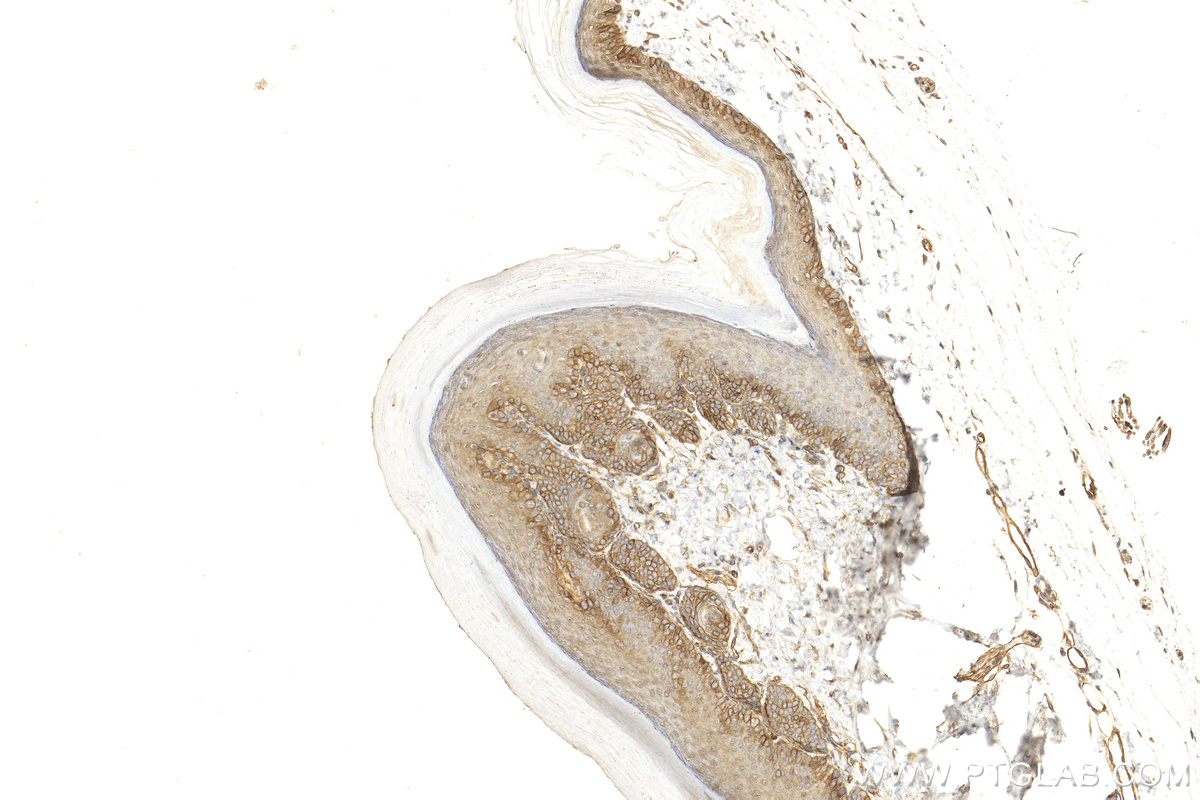 IHC staining of mouse skin using 27189-1-AP