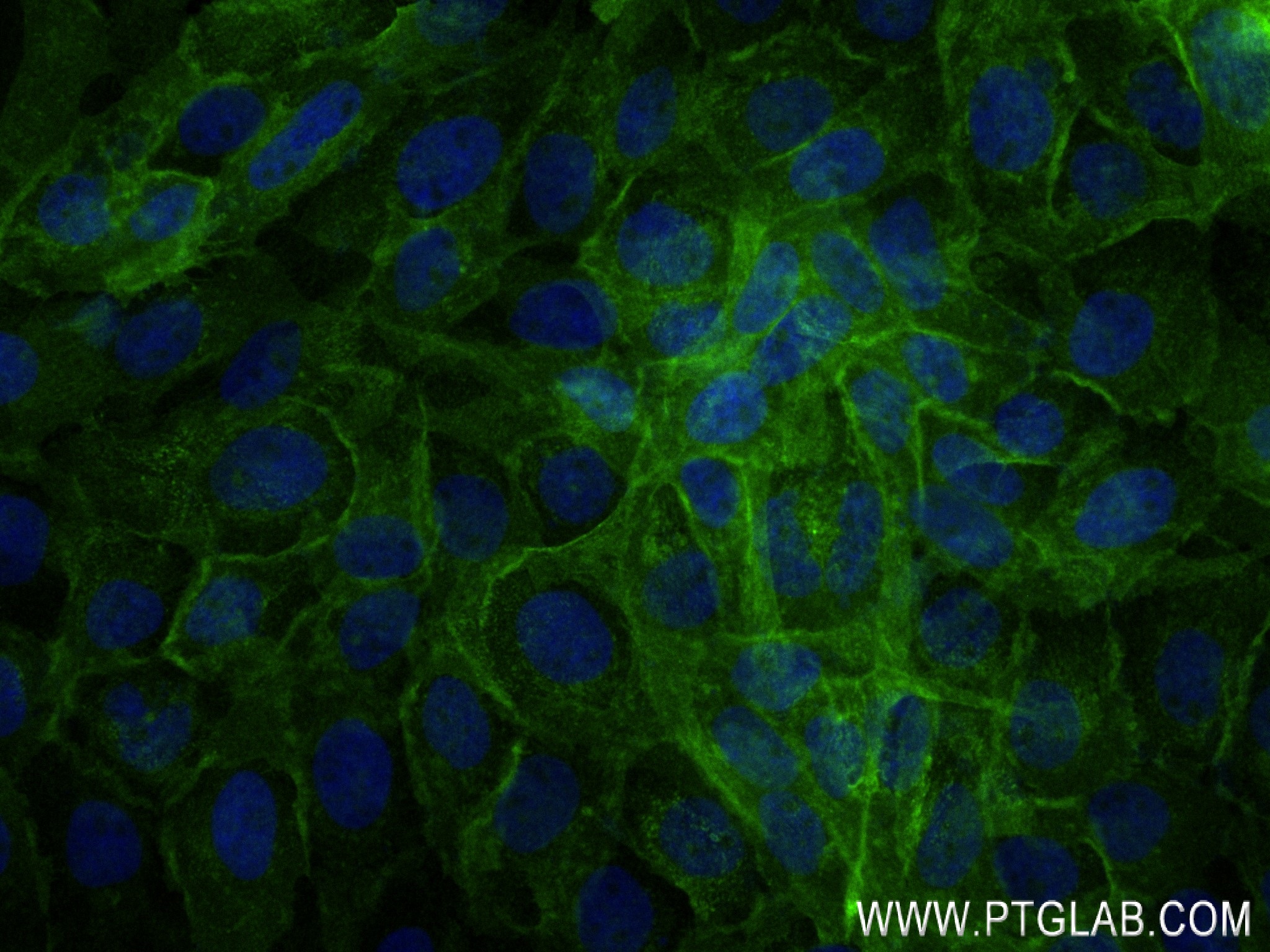 IF Staining of A431 using 84463-3-RR (same clone as 84463-3-PBS)