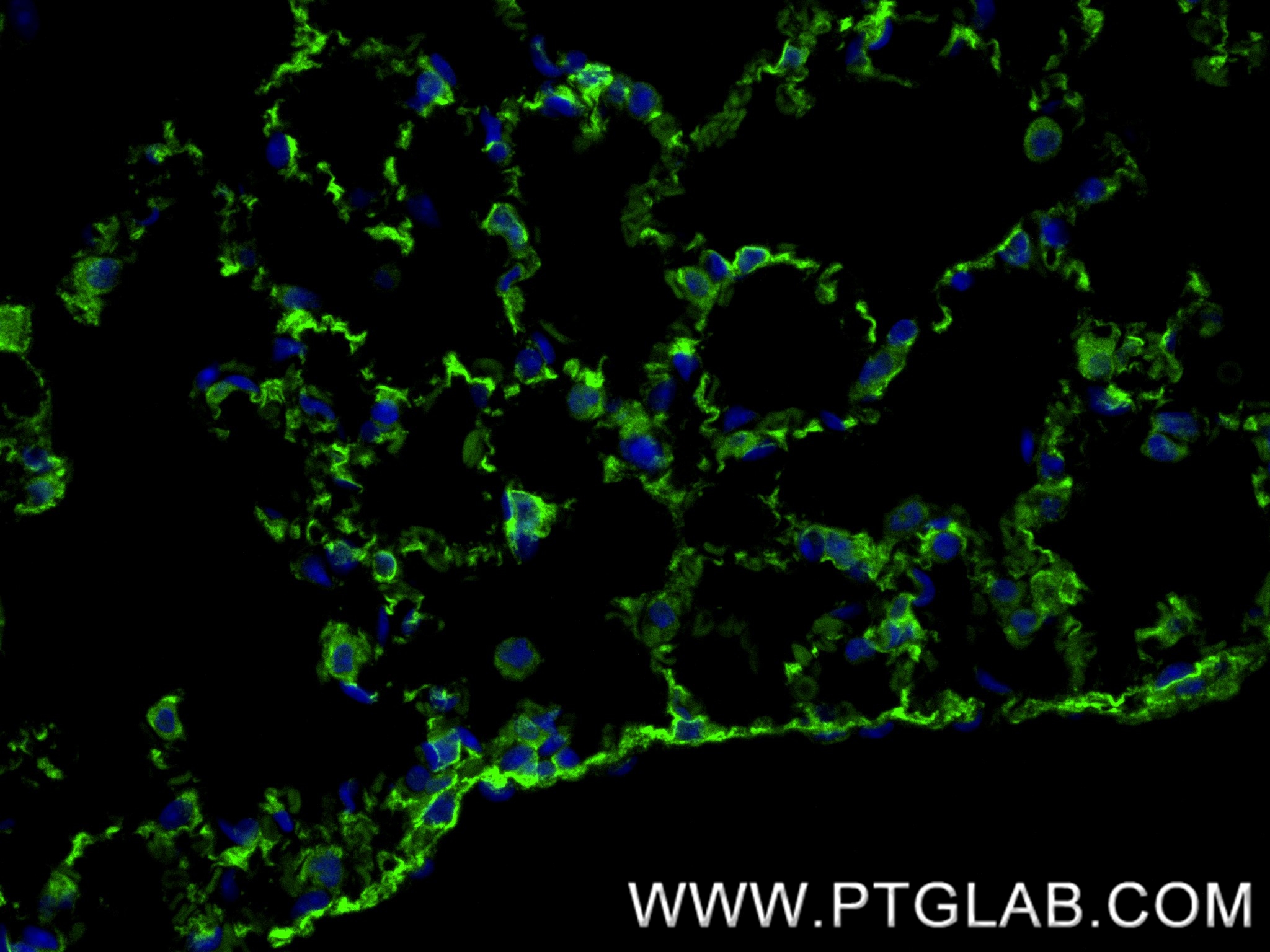 IF Staining of mouse lung using 87408-1-RR IF Staining of mouse lung using 87408-1-RR