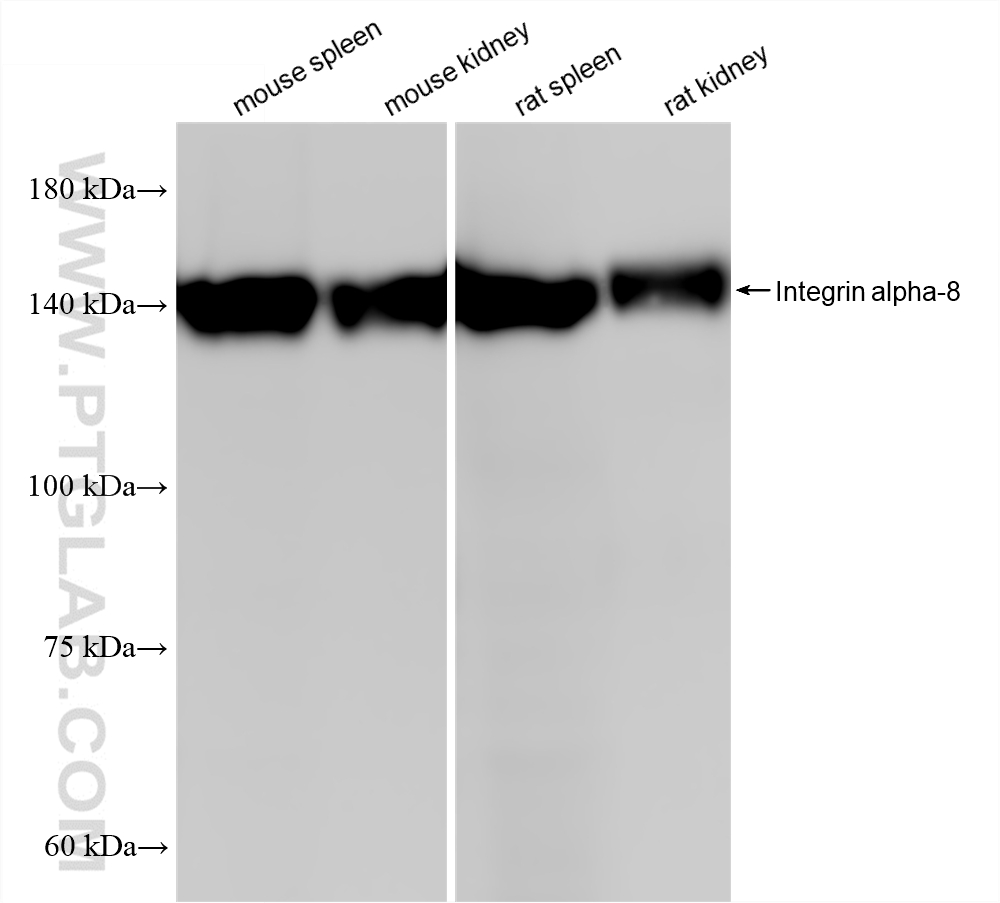 WB analysis using 87408-1-RR WB analysis using 87408-1-RR