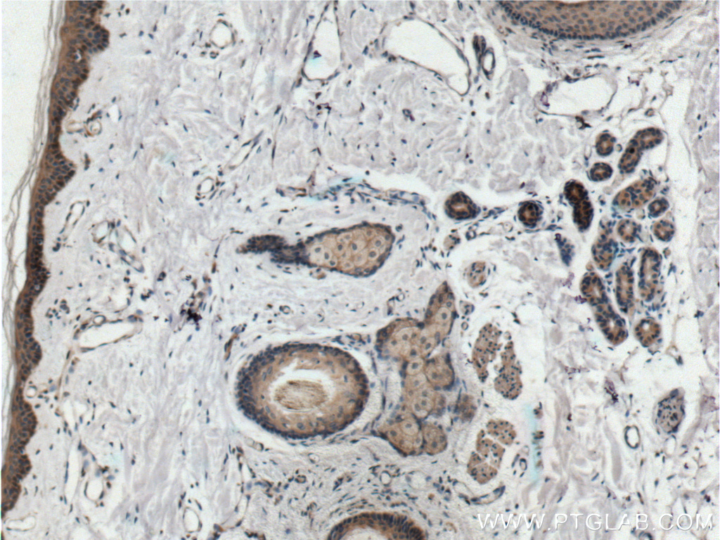 IHC staining of human skin using 26918-1-AP