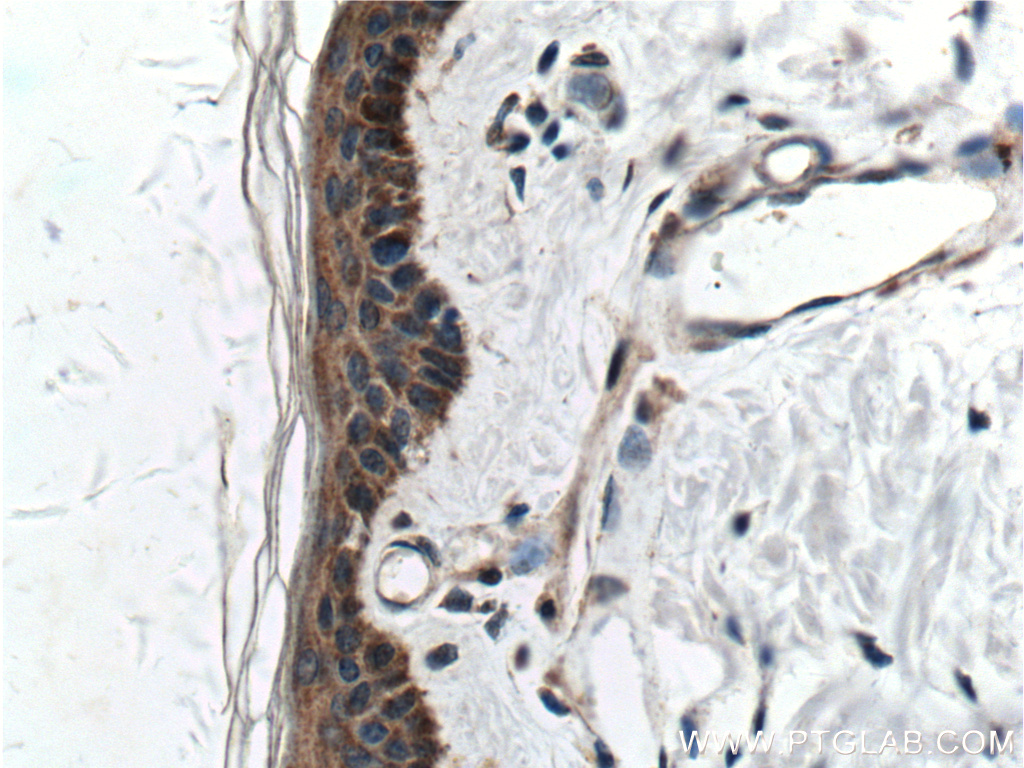 IHC staining of human skin using 26918-1-AP