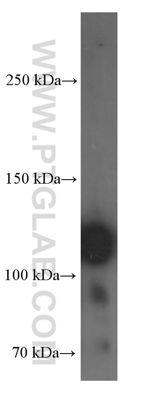 Integrin Beta 1