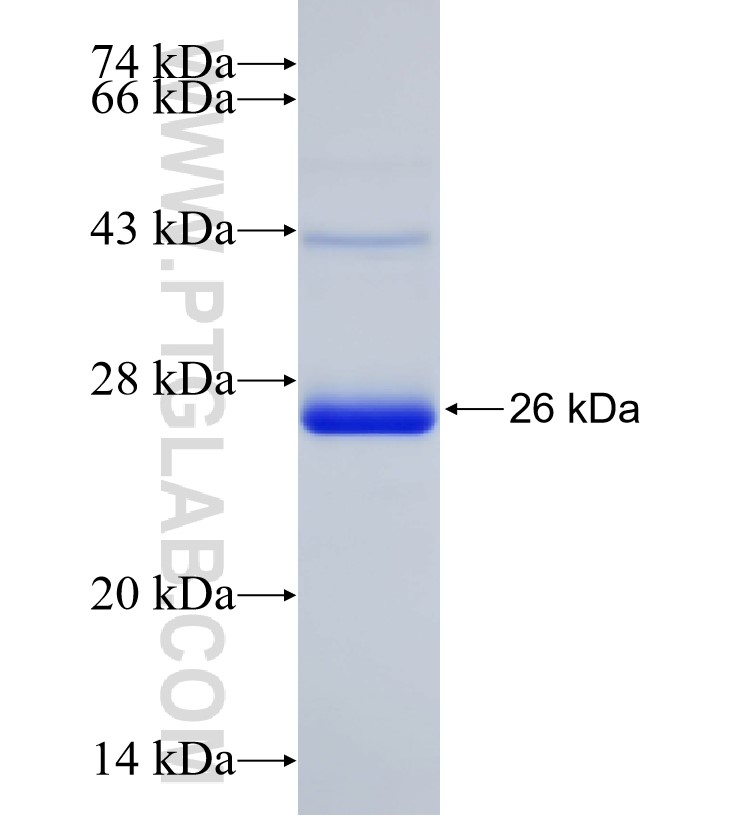 Integrin beta-1 fusion protein Ag25406 SDS-PAGE