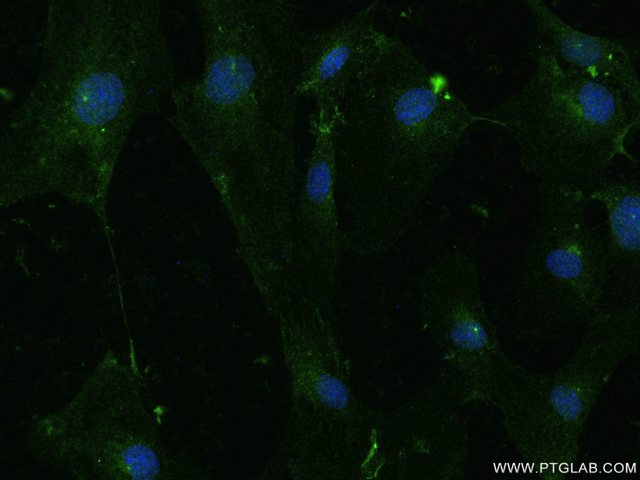 IF Staining of HUVEC using 83053-4-RR