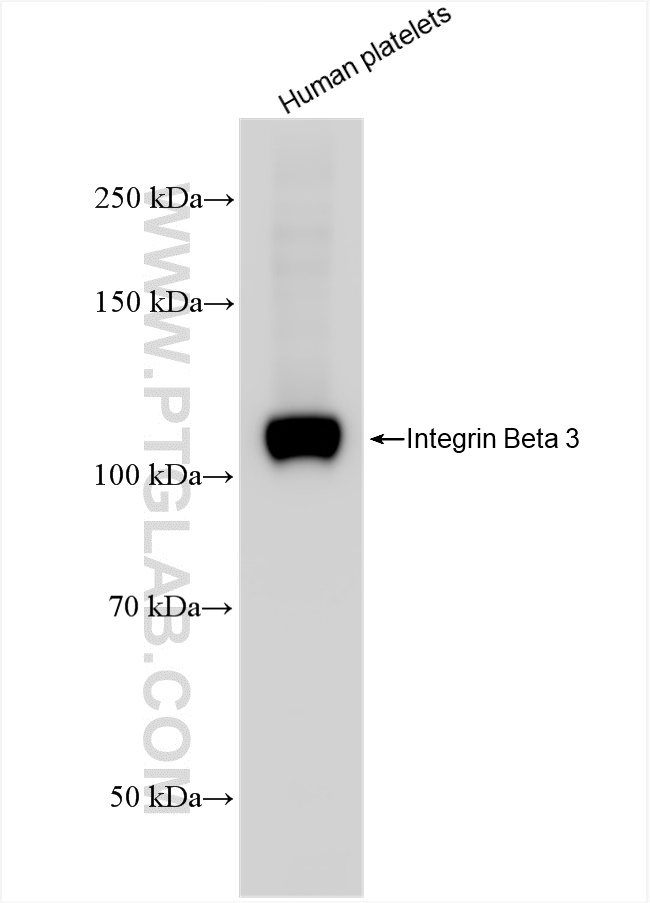 WB analysis of human peripheral blood platelets using 83053-6-RR