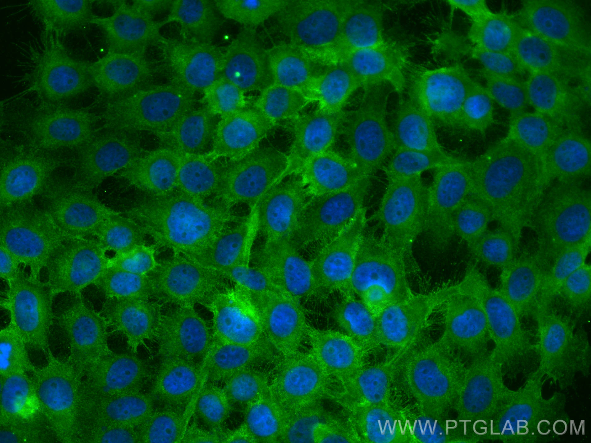 IF Staining of A431 using 66922-2-Ig