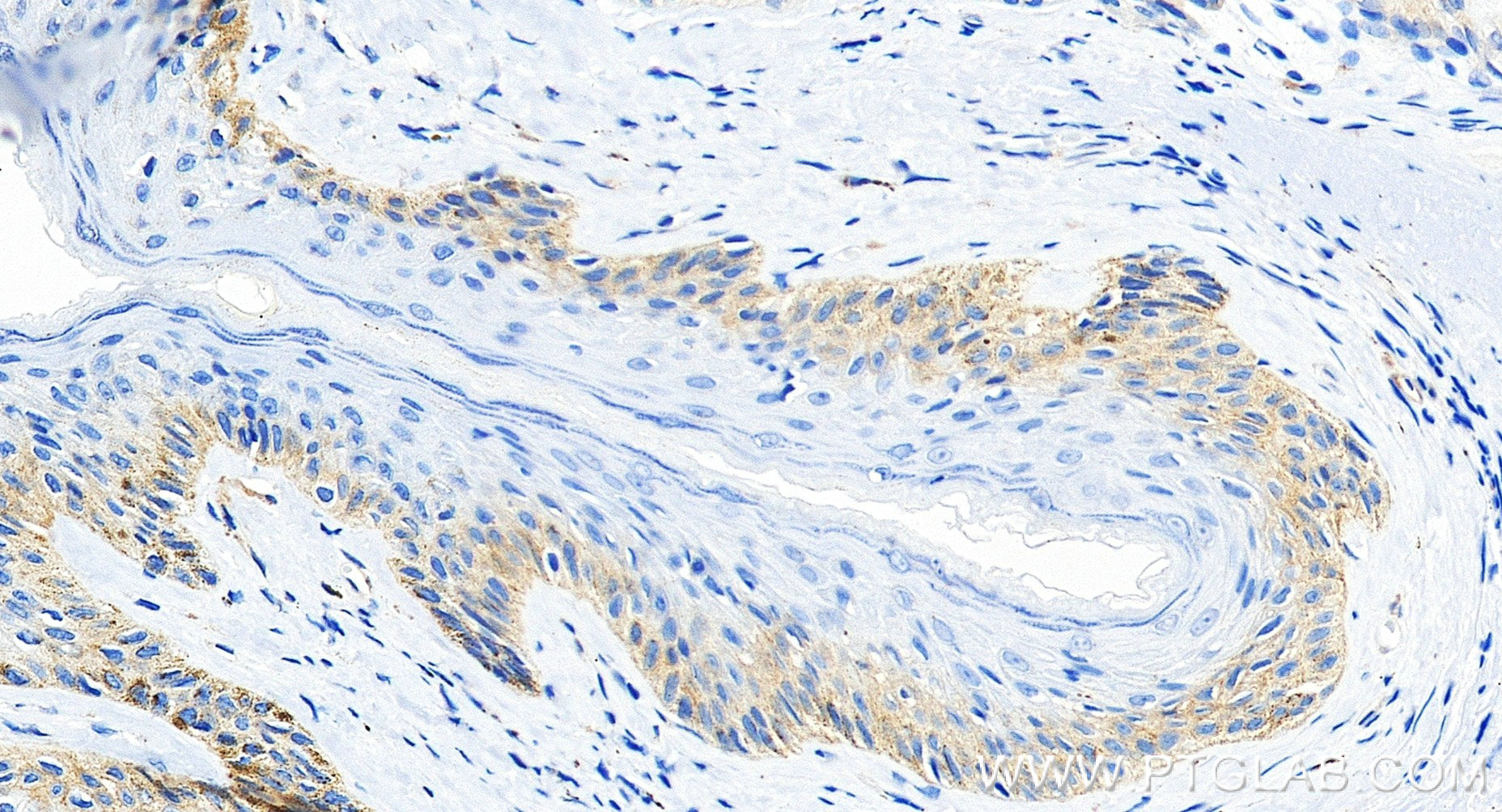 IHC staining of human skin using 98774-1-RR (same clone as 98774-1-PBS) IHC staining of human skin using 98774-1-RR (same clone as 98774-1-PBS)