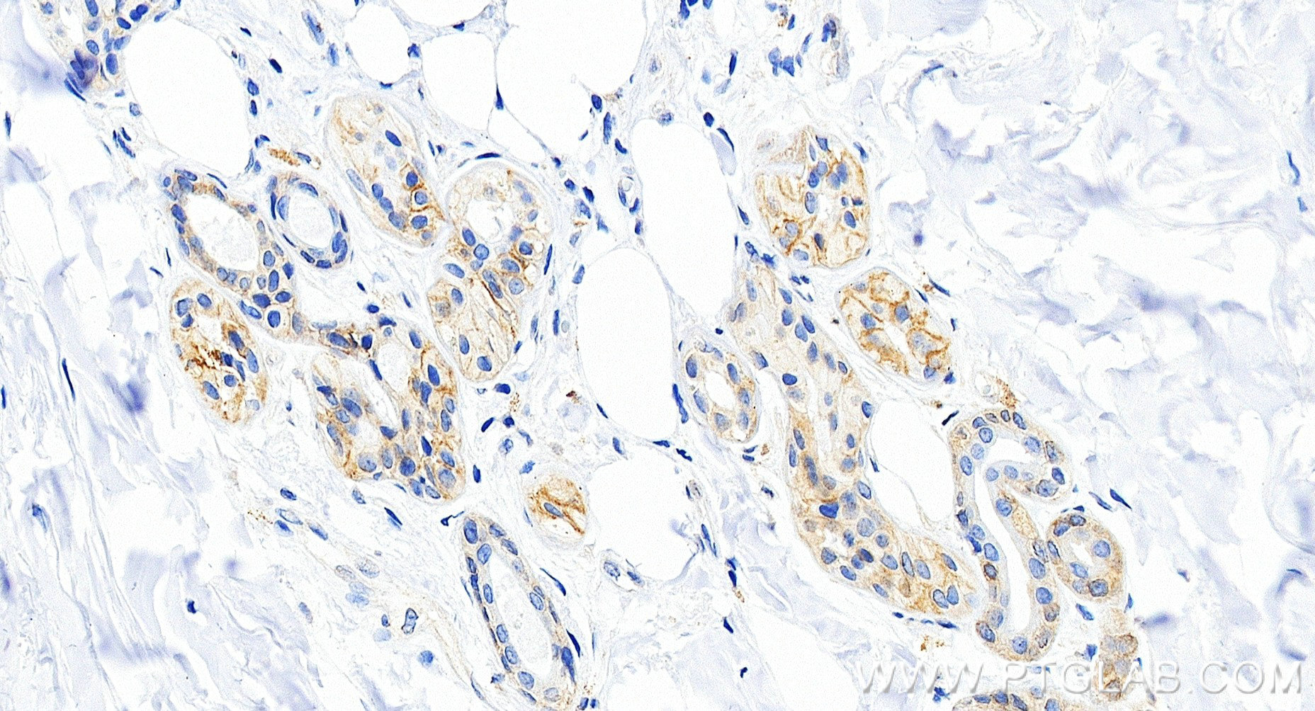 IHC staining of human skin using 98774-1-RR (same clone as 98774-1-PBS) IHC staining of human skin using 98774-1-RR (same clone as 98774-1-PBS)