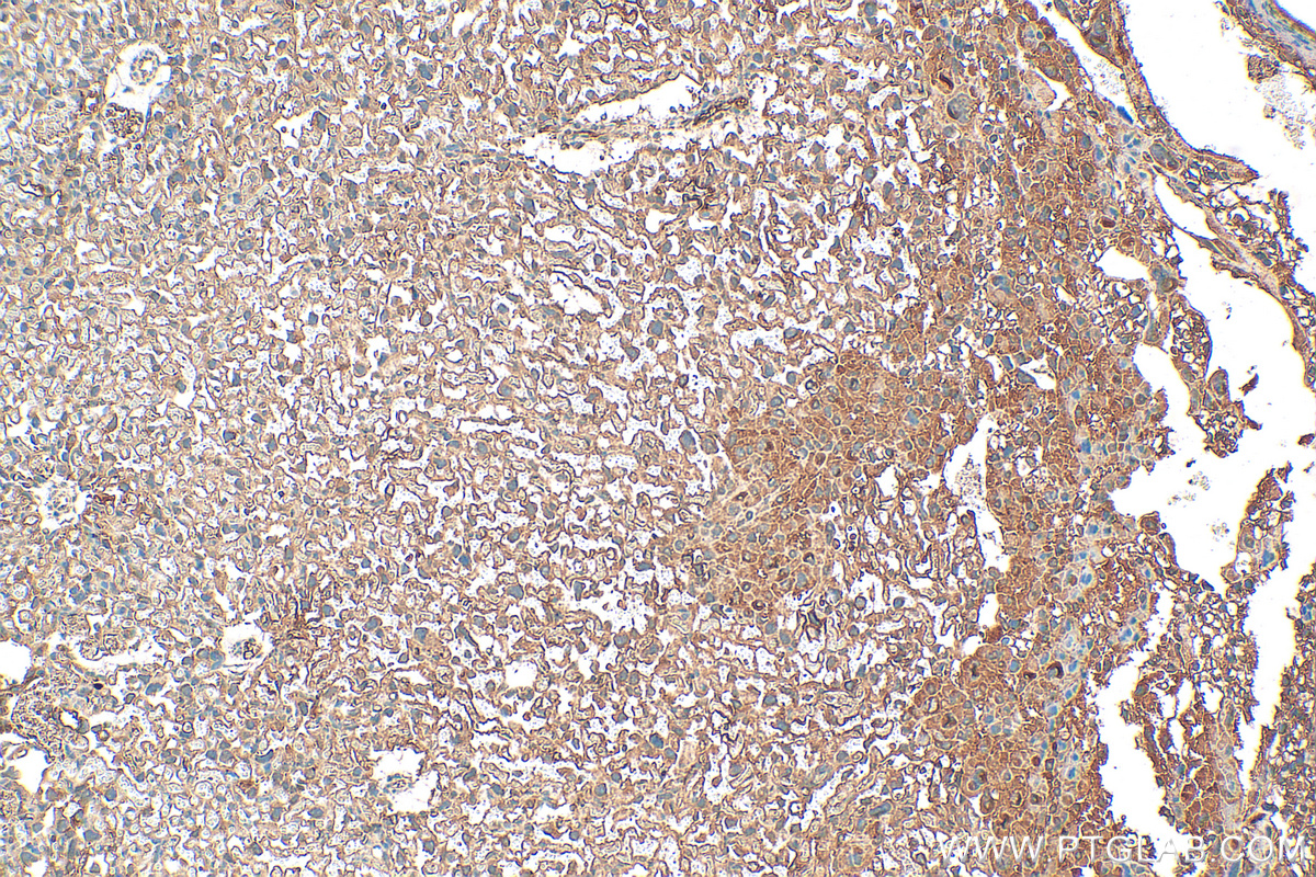 IHC staining of mouse placenta using 28543-1-AP