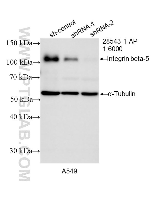 WB result of Integrin Beta 5 antibody (28543-1-AP; 1:6000; incubated at room temperature for 1.5 hours) with sh-Control and sh-Integrin Beta 5 transfected A549 cells. WB analysis of A549 using 28543-1-AP