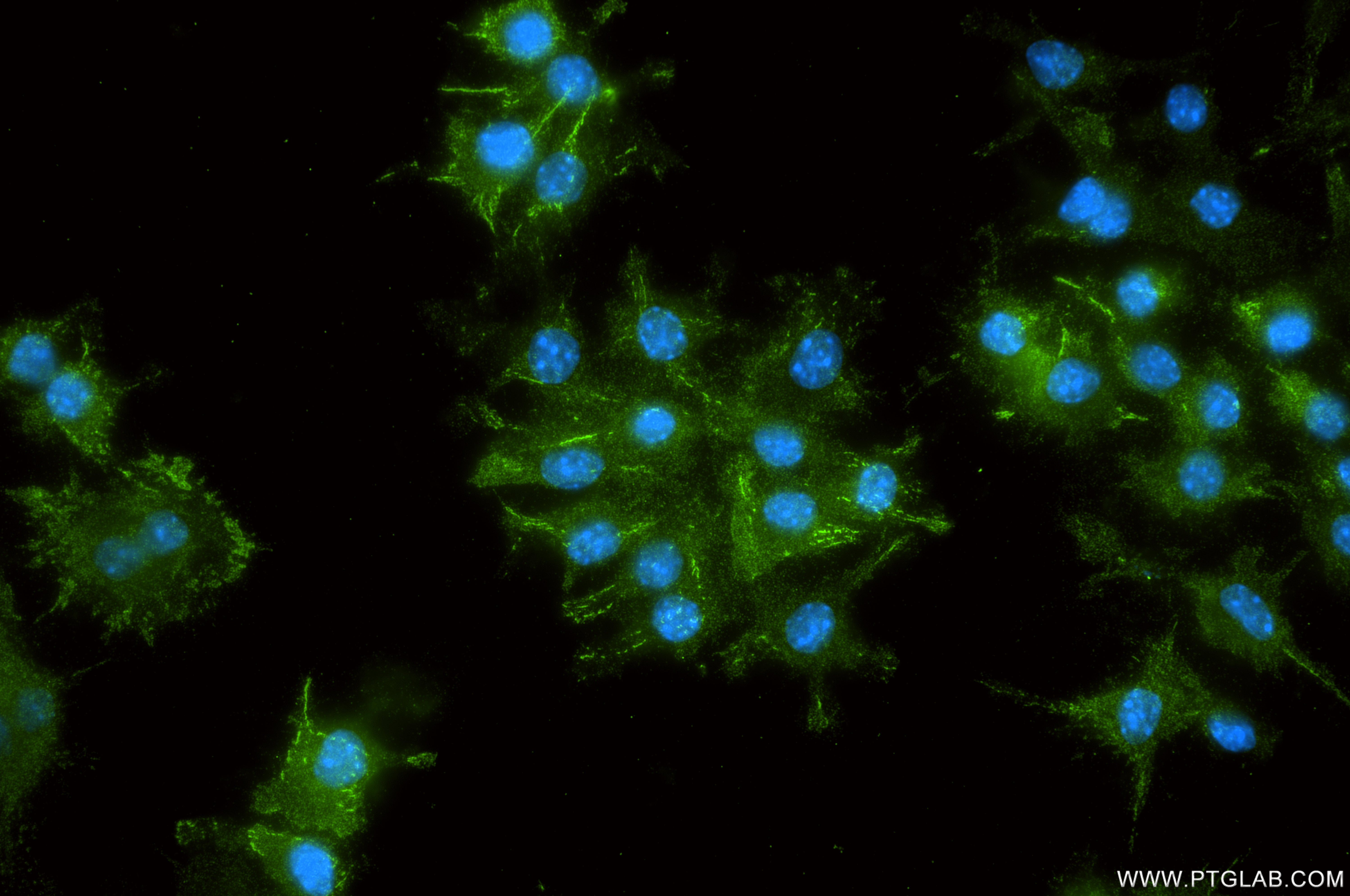 IF Staining of RAW 264.7 using 87465-1-RR