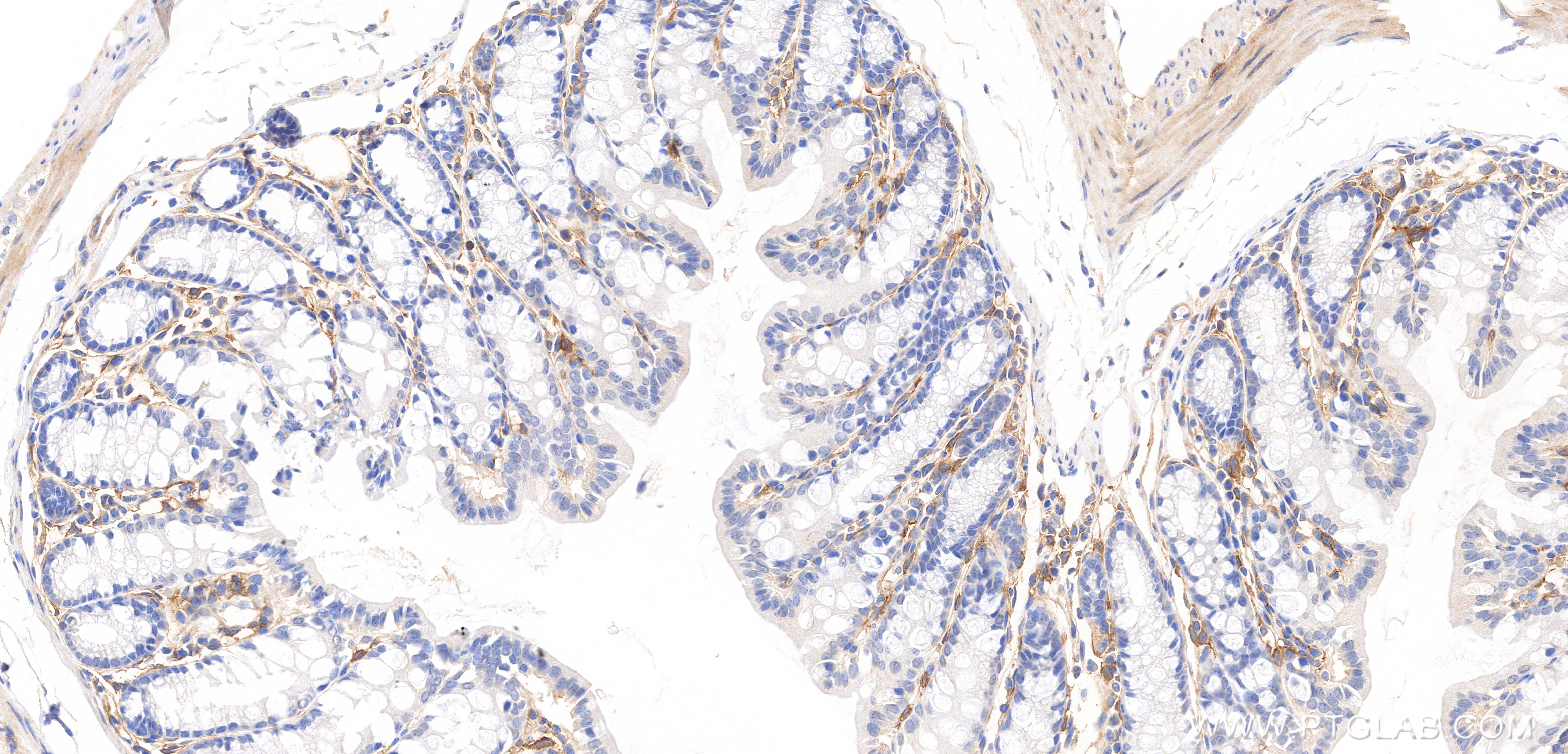 IHC staining of mouse colon using 87465-1-RR