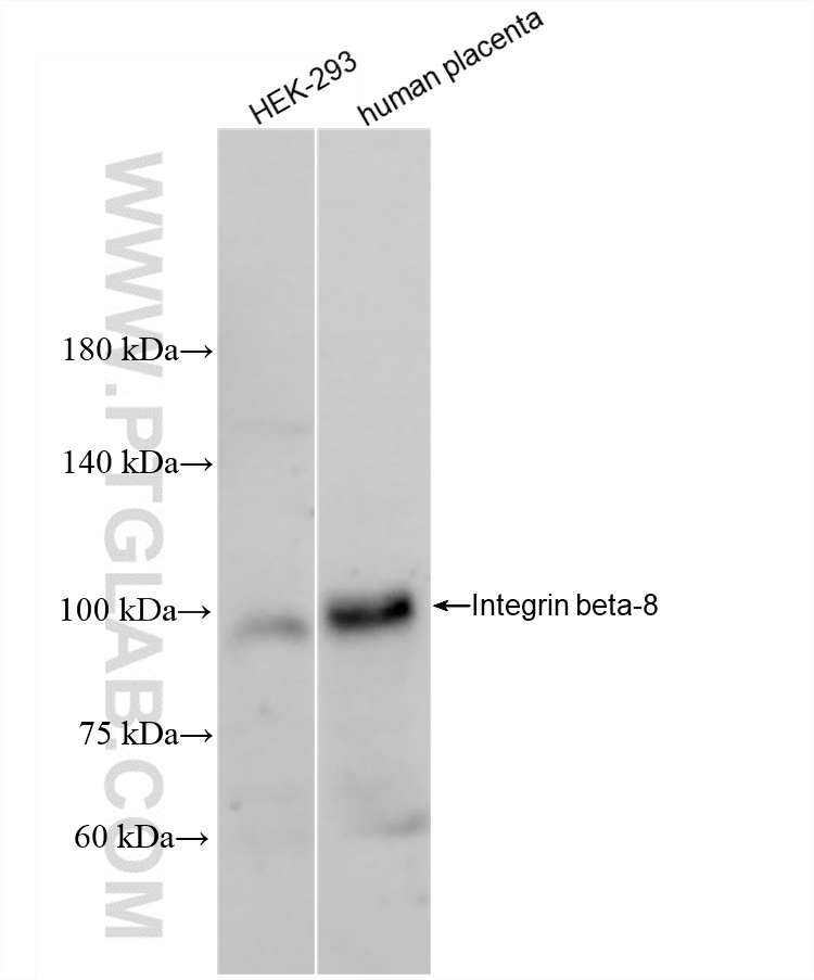WB analysis using 84558-1-RR